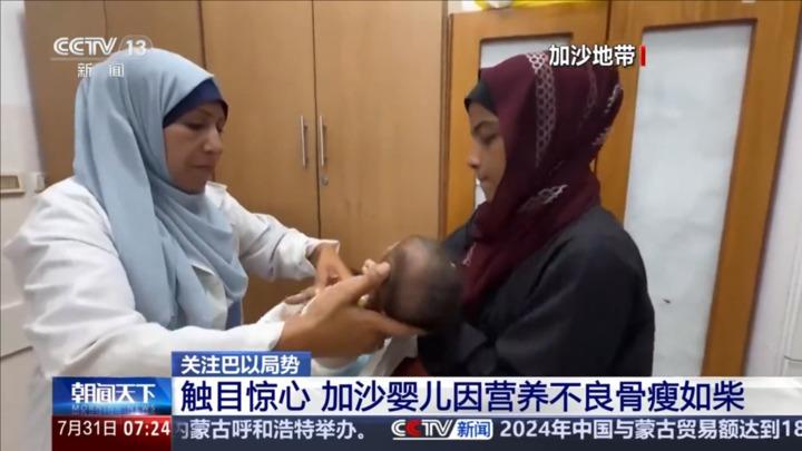 触目惊心 加沙婴儿因营养不良骨瘦如柴
