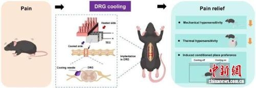 Chinese institute develops new cooling device for pain relief
